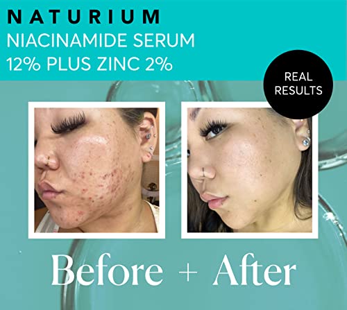 Naturium Niacinamide Serum 12% Plus Zinc 2%, 1 fl oz