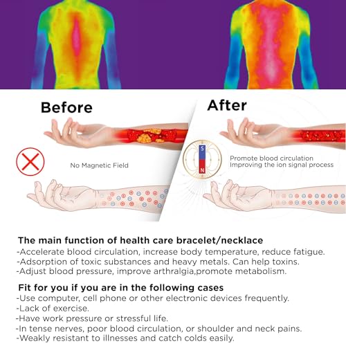 Magnetic Healing Bracelet – Adjustable Hematite Bracelet for Lymph Drainage, Arthritis, Anxiety Relief, Swelling Reduction & Weight Loss – Slimming Bracelet for Women & Men