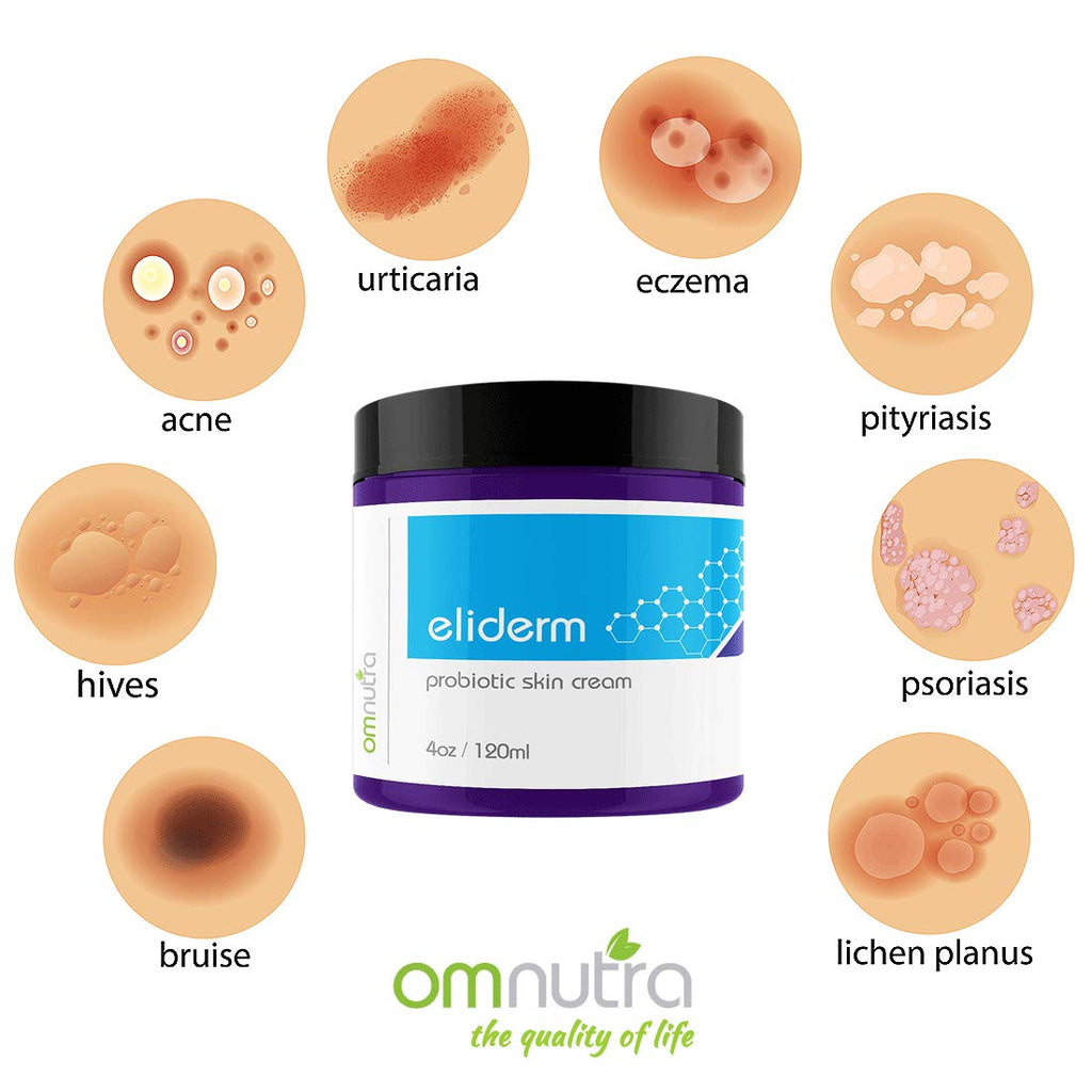 Topical Probiotic Skin Cream - 4OZ Jar 13 Strain Moisturizing Probiotic Lotion Eczema Treatment Psoriasis Treatment for Cystic Acne Probiotic Skin Care Cream Nail Fungus Treatment